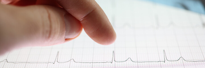 Thumb over tablet with heart cardiogram image