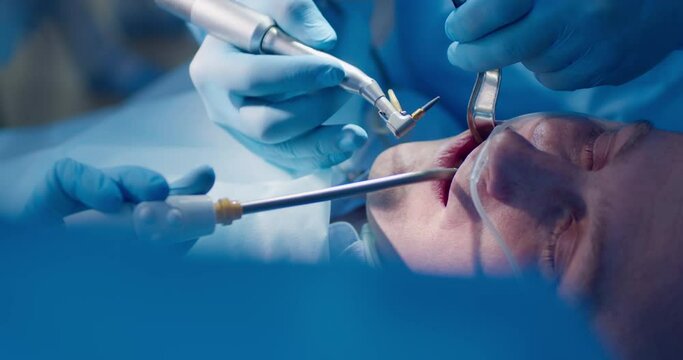 Close-up an adult male patient who is laying under anesthesia while the dentist inserting to his mouth a dental drill and his assistant is putting a saliva ejector for the teeth treatment.
