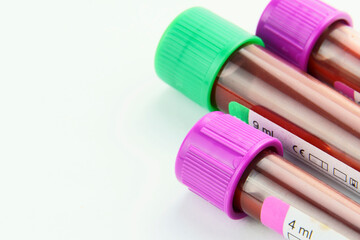 Vacuum tubes for collection and blood samples on white background..Transparent with purple and green lid. Label to identify the data. Selective focus. Macro.