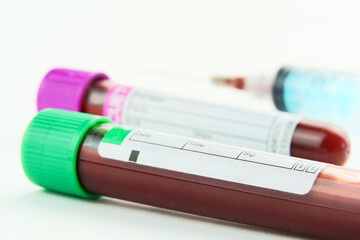 Vacuum tubes for collection and blood samples on white background..Transparent with purple and...