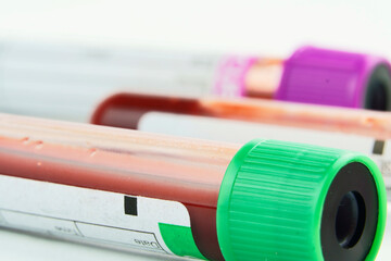 Vacuum tubes for collection and blood samples on white background..Transparent with purple and...