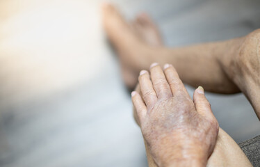 Fototapeta premium The hand of old man with the wrinkled hand and bruised from the body lack of nutrition protein.