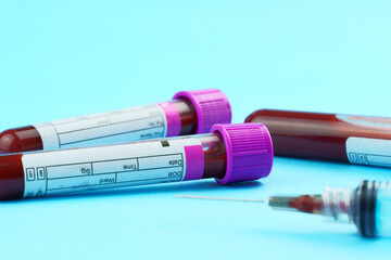 Vacuum tubes for collection and blood samples on white background..Transparent with purple and...