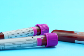 Vacuum tubes for collection and blood samples on blue background..Transparent with purple and green...