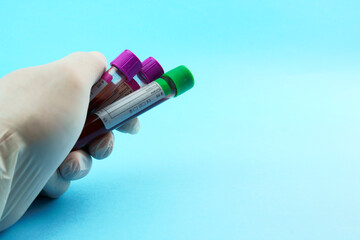 Hand with surgical glove holding vacuum tubes for collection and blood samples on blue...