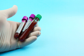 Hand with surgical glove holding vacuum tubes for collection and blood samples on blue background..Transparent with purple and green cap and a syringe. Label to identify the data. Selective focus.