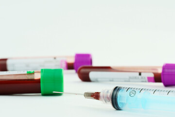 Vacuum tubes for collection and blood samples on white background..Transparent with purple and...