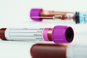 Vacuum tubes for collection and blood samples on white background..Transparent with purple and...