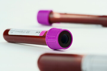 Vacuum tubes for collection and blood samples on white background..Transparent with purple and...