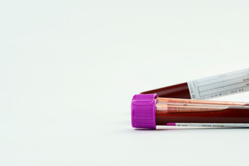 Vacuum tubes for collection and blood samples on white background..Transparent with purple and...