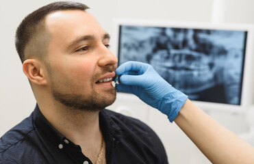 Young woman dentist selecting a shade of enamel for implantation. Male patient consults on dental treatment in a modern dental clinic. Close up shooting