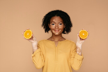 Beauty, cosmetic. Woman with problem skin and vitiligo holds oranges in her hands. Cosmetic with...