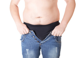 Naklejka premium An obese man tries to put on tight little shorts on a white background. Overweight concept, wrong lifestyle