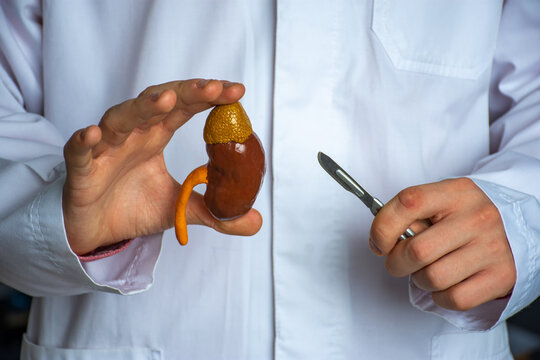 Kidney and adrenal surgery medical surgical photo idea. The doctor holds in one hand a model of a kidney with a ureter, and in the other a scalpel, depicting a surgical operation to treat or remove 