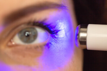 Professional removal of skin scars using laser resurfacing. Beautiful girl performs a procedure to...