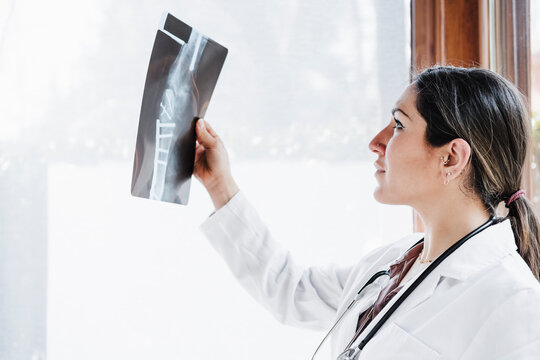 Female medical expertise examining bone x-ray image by window
