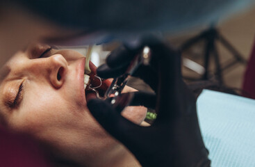 Young woman having dental exam. Close up tooth.