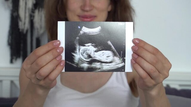 Slow Motion Pregnant woman holding scan of baby 