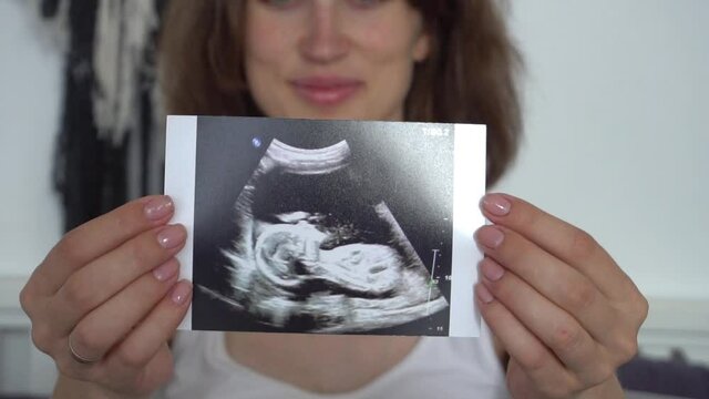Closeup of a pregnant woman with an  scan of baby in her hands