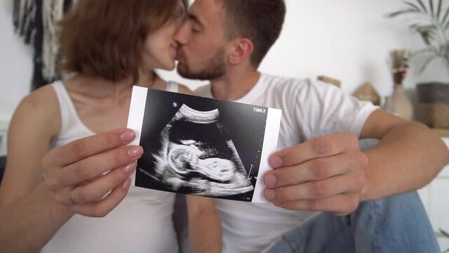 Slow Motion Beautiful pregnant couple with sonogram image at home