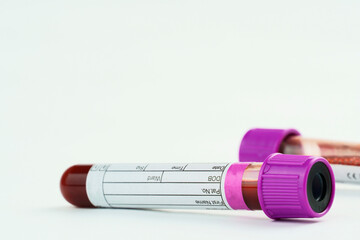 Vacuum tubes for collection and blood samples on white background. Transparent tubes with purple...