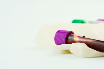 Vacuum tubes for collection and blood samples, a syringe and a surgical glove on white background....