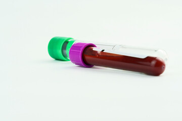 Vacuum tubes for collection and blood samples on white background. Transparent tubes with purple...