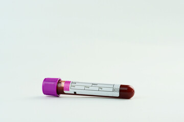 Vacuum tube for collection and blood samples on white background. Transparent tube with purple lid....