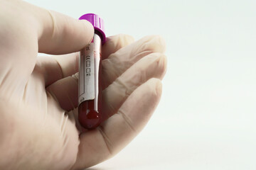 Hand with surgical glove holding vacuum tube for collection and blood samples on white background....