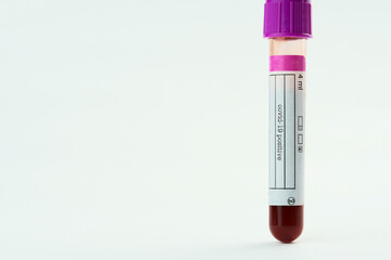 Vacuum tube for collection and blood samples on white background. Transparent tube with purple lid....