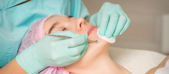 Facial cleansing. Blackhead Removal Tool. Beautician removing blackhead and acne on female chin in...