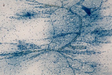 Motor Neurons under the microscope