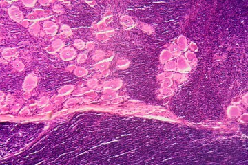 Longitudinal section of human spinal ganglion cells under the microscope.