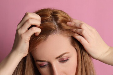 Naklejka premium Woman suffering from baldness on pink background, closeup