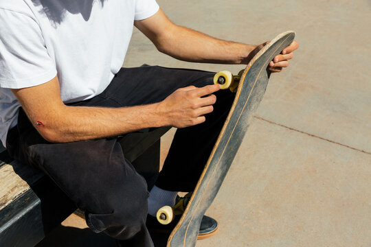 Man's hands with a scrape touching a wheel of his skateboard