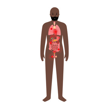 recommend clip art: Pain in male body