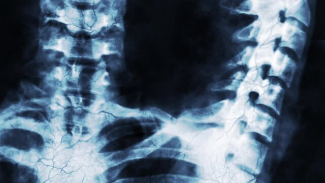 Human bone x-ray or medical research
