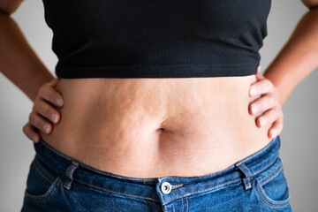 Fototapeta premium Fat Woman Belly Button And Body
