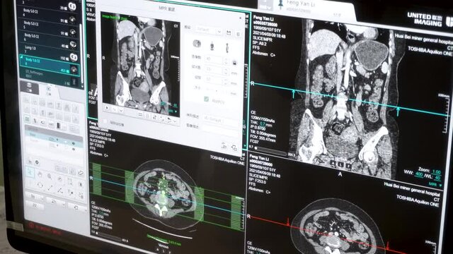 Doctors perform CT、 magnetic resonance medical examinations 
