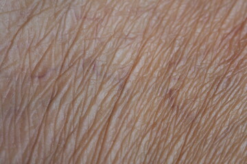 Selective focus of wrinkles skin in deep layers and red varicose veins. Skin repair and treatment...