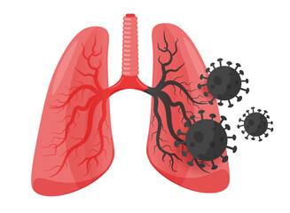 Damage to the human lung organ by the pathogenic covid19 virus. Coronavirus of respiratory diseases. Isolated on a white background. Vector illustration