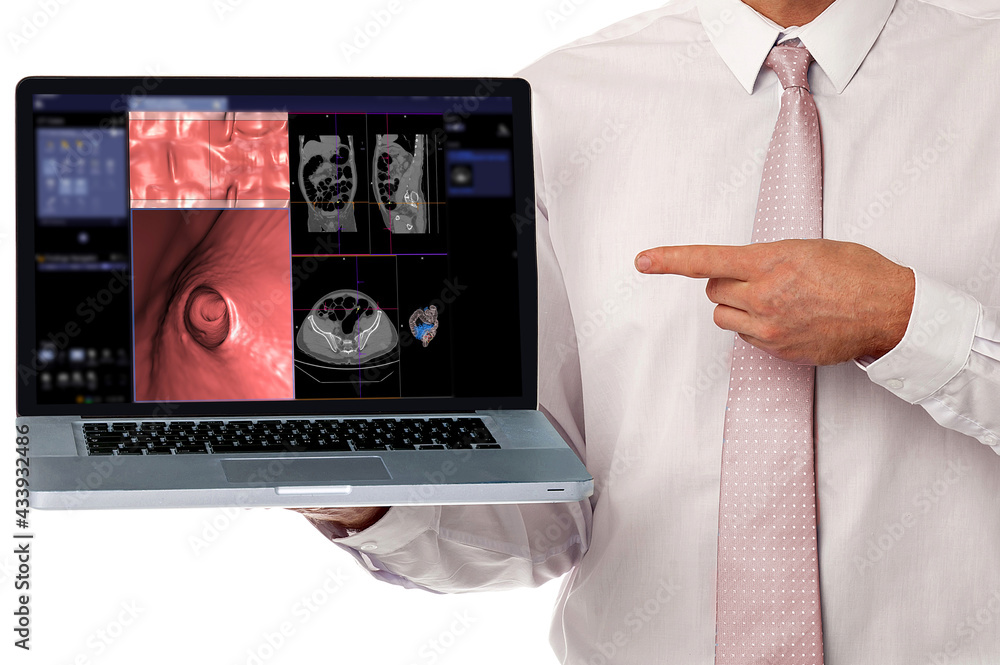 Aufkleber doctor working with notebook showing ct colonography or ct scan of colon axial view vs coronal view 