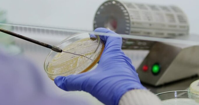 a scientist conducts an experiment in a laboratory, collects bacteria from a petri dish with a microbiological loop.