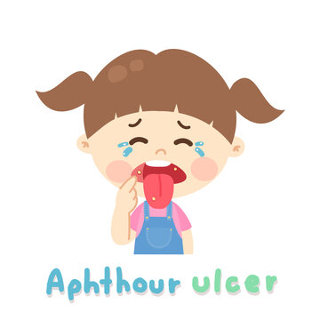 Kids have a Mouth Ulcer vector