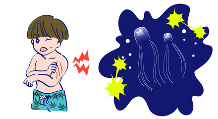 クラゲの毒 © YukaHashimoto