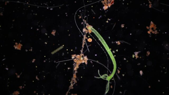 Bacteria,Protozoa and Green Algae in waste water under the microscope.

