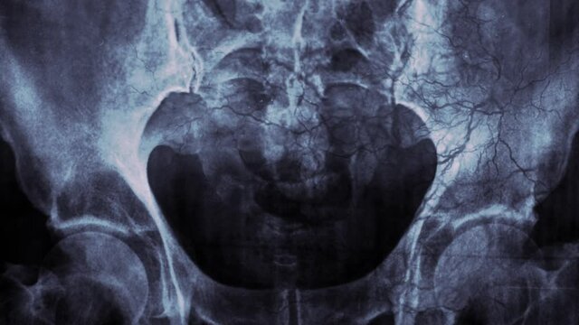 Human pelvic X-ray or medical research