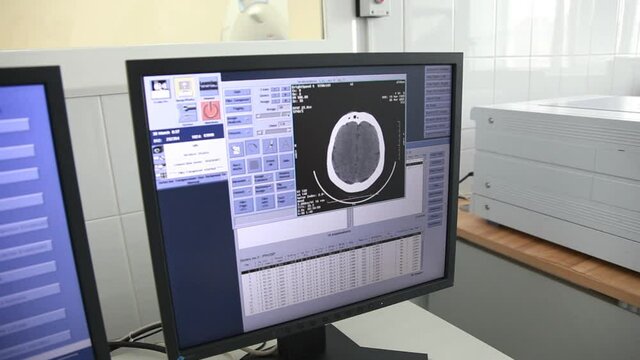 digital images of the skull are viewed on a computer in the hospital. medical procedure for diagnosing brain damage