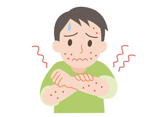 じんましんの出ている男性