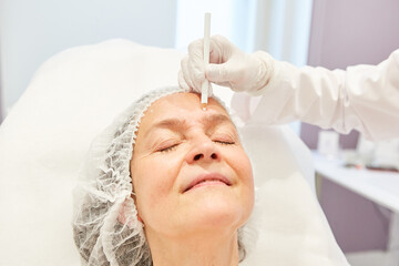 Seniorin bekomm Markierung im Gesicht für Facelift